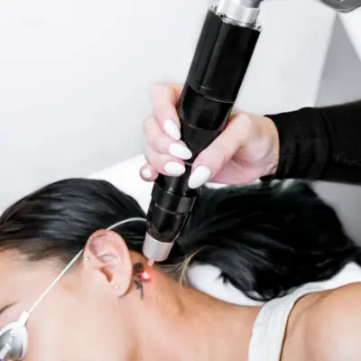 tattoo removal